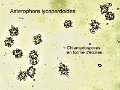 Asterophora lycoperdoides-amf1355-micro